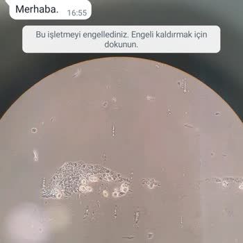 WhatsApp Bilinmeyen Numara