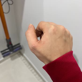 Dyson V8 Süpürge Parmağımı Nasır Etti