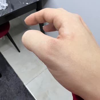 Dyson V8 Süpürge Parmağımı Nasır Etti