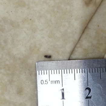 BİM Marketten Alınan Yufkalarda (sebit) Böcek Çıktı