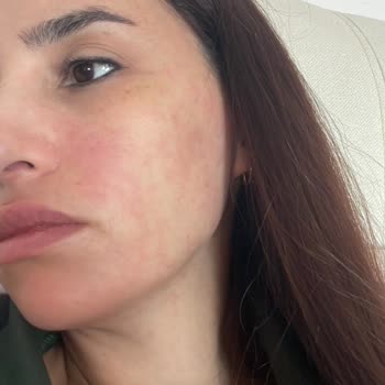 Abdi İbrahim Factive 7 320 Mg