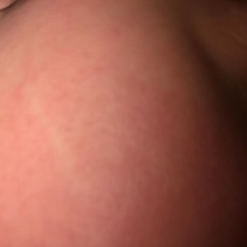 Cream Co. Creamco Mavi Nemlendirici