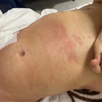 Adnan Menderes Üniversitesi Hastanesi Hastane İhmalleri Ve Doktor Hatası Yüzünden Ölüm