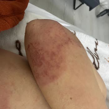 Adnan Menderes Üniversitesi Hastanesi Hastane İhmalleri Ve Doktor Hatası Yüzünden Ölüm