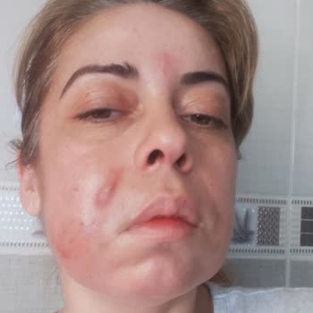 Özel Ortadoğu Hastanesi (Ankara) Özel Ortadoğu Hastanesinde Kayıt Dışı İşlem Yapılıyor