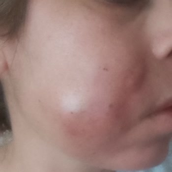 Özel Ortadoğu Hastanesi (Ankara) Özel Ortadoğu Hastanesinde Kayıt Dışı İşlem Yapılıyor