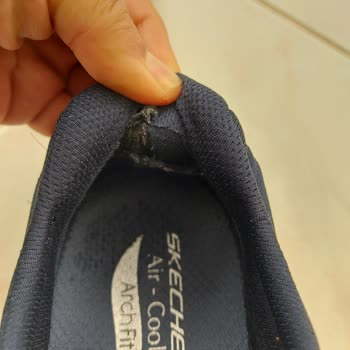 Skechers Ayakkabı Şikayetim Var.