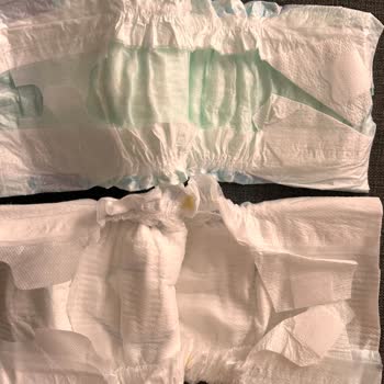 Molfix Bezin İçerisinden Farklı Bezler Çıktı