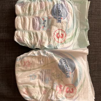Molfix Bezin İçerisinden Farklı Bezler Çıktı