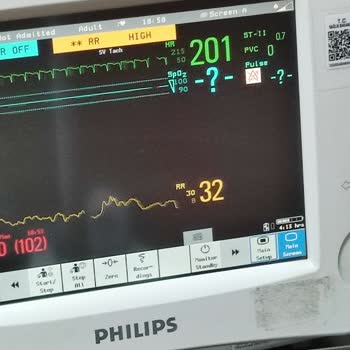 Mehmet Akif Ersoy Göğüs Kalp ve Damar Cerrahisi Eğitim ve Araştırma Hastanesi Kalp Ve Damar Hastanesinde Randevu Süreci Sorunları