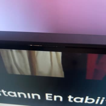 Philips TV Ekranda Işık Sızması