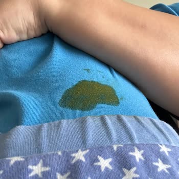 Prima Premium Care Sızdırma Ve Islaklık