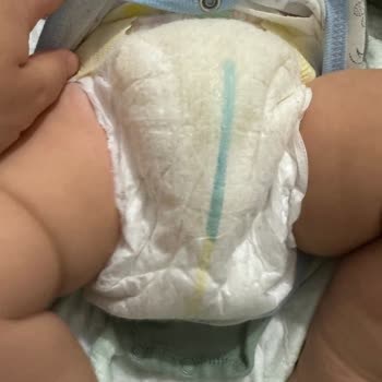 Prima Premium Care Sızdırma Ve Islaklık