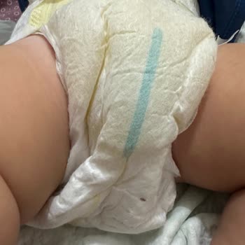 Prima Premium Care Sızdırma Ve Islaklık