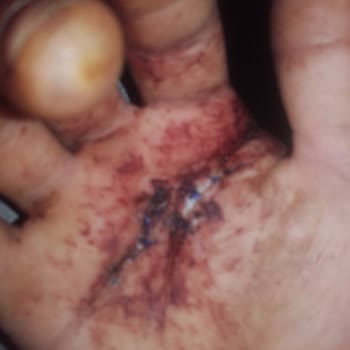 İBB Sosyal Yardım Problemi