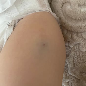 Özel İlgi Çocuk Sağlığı Merkezi (Gebze) Hastane Ziyareti Karmaşası