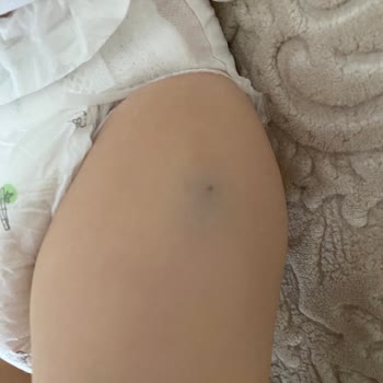 Özel İlgi Çocuk Sağlığı Merkezi (Gebze) Hastane Ziyareti Karmaşası