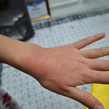 Fax Sabun Şok'tan Aldığım Faks Guzellik Sabunu Alerji Yapıyor