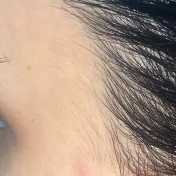 Novar Poliklinik Novar'ın Kalitesizliği Nokta