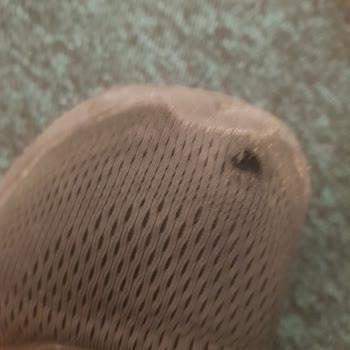 Adidas Yırtık Ayakkabı Hızlıca Yırtılan Ayakkkabı