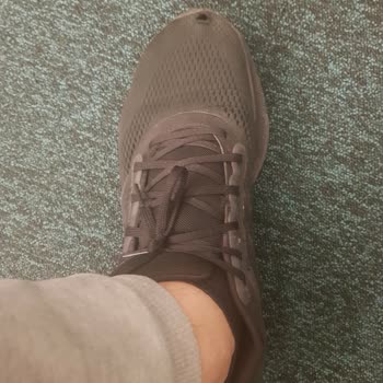 Adidas Yırtık Ayakkabı Hızlıca Yırtılan Ayakkkabı