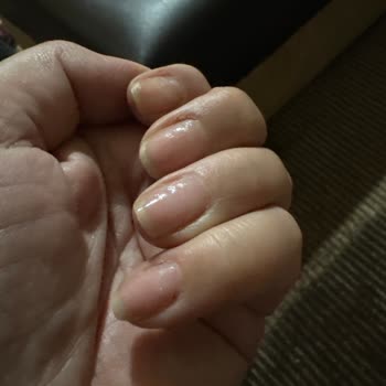 Pronail Ürünleri Sağlıksız Personeli Eğitimsiz