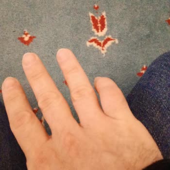 Prof. Dr. Alper Gökçe Hatalı Ameliyat