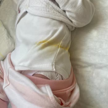 Prima Premium Care Sızdırıyor