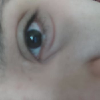 The NewLab. Göz Altı Serumu Kullanıcı Deneyimi