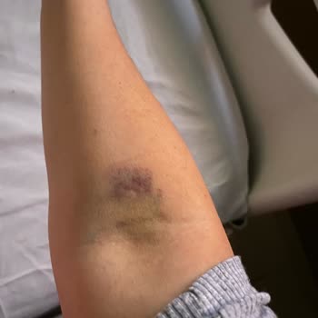 ParkHayat Afyon Hastanesi'nde Tüp Bebek Merkezi Deneyimim