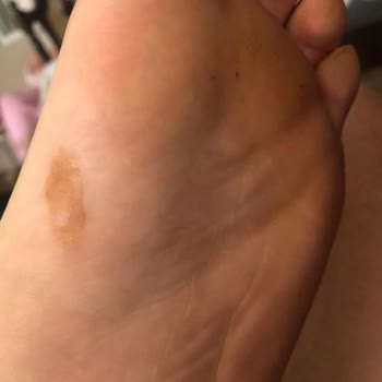 Nike Alphafly 2 Erkek Yol Yarış Ayakkabısı
