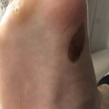 Nike Alphafly 2 Erkek Yol Yarış Ayakkabısı