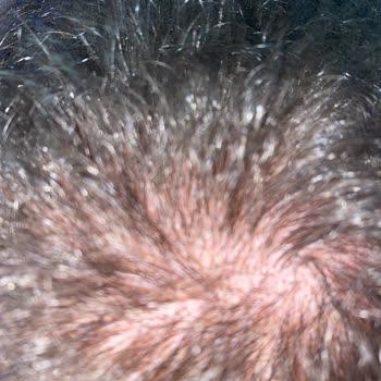 Herbal Essences Şampuan Saç Döküyor