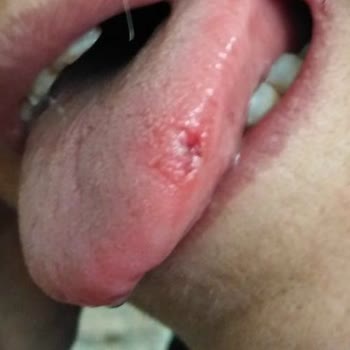 Nevşehir Ağız Ve Diş Sağlığı Merkezi Diş Hekiminin İhmali