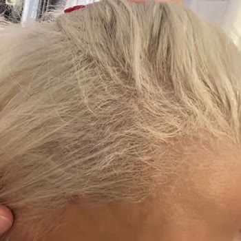 Sedat Biga Hair Studio Kuaför Randevusunda Yaşanan Talihsiz Deneyim