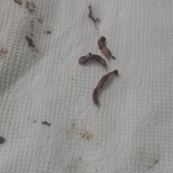 Nutella'dan Tırnak Çıktı