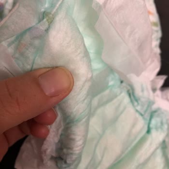 Molfix Bebek Bezinde Rahatsız Edici Sertlikler Var