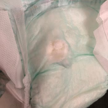 Molfix Bebek Bezinde Rahatsız Edici Sertlikler Var