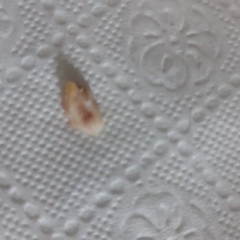 Lezita Piliç Kroket İçinden Kemik Parçası Çıkması