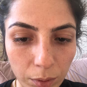 Aris Çukurambar Vip Aris Çukurambar Güzellik Merkezi