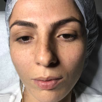 Aris Çukurambar Vip Aris Çukurambar Güzellik Merkezi