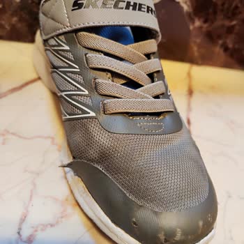 Skechers Ayakkabıda Erken Deformasyon