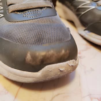 Skechers Ayakkabıda Erken Deformasyon