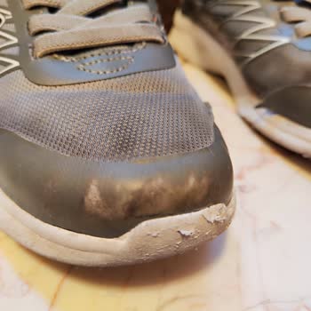 Skechers Ayakkabıda Erken Deformasyon