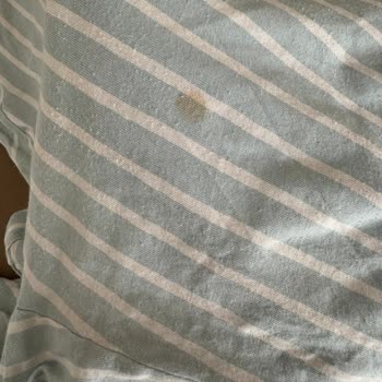 Bosch Çamaşır Makinesi Kir Çıkarmıyor