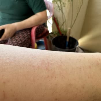 Nets Polikliniği Lazer Epilasyon Memnuniyetsizliği