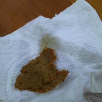 Beşler Marka Dönerden Kıl Çıktı