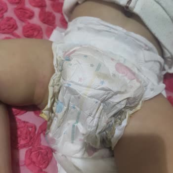 BİM Agu Bay Bebek Bezinden Memnun Kalmadım!