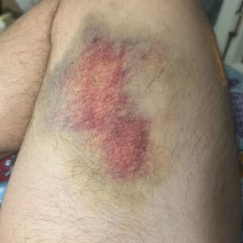 İBB - İstanbul Büyükşehir Belediyesi Toplu Taşıma Şoförü Dikkatsizliği