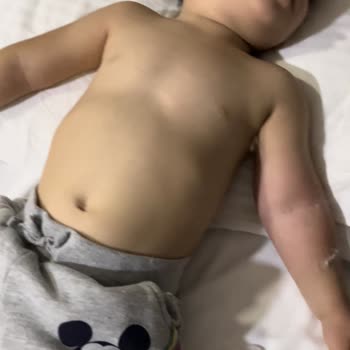 Özel Erciyes Hastanesi Sağlığınızı Seviyorsanız Erciyes Kartal Hastanesine Asla Uğramayın.!